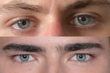 Medjeet stare vs White stare