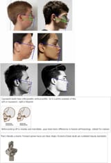 Caucasoid vs Negroid