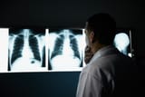 analyzing x-rays