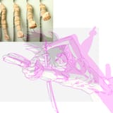 foreshortening