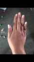 skin whitening_thumb.jpg