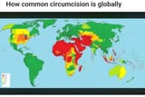 Circumcision