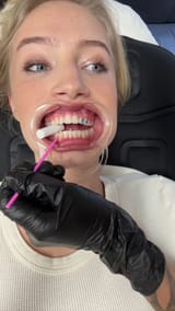 00