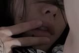 lips