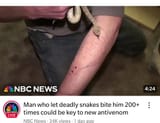 white man lets himself get biten by snakes 200 times for fun
