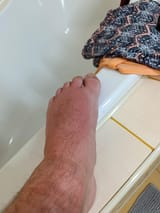 foot