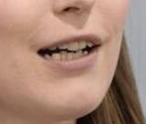 euroteeth