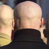 070723skinheads