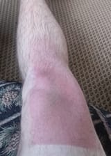 tanline