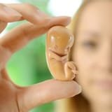 Aborcja (1)