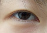 Epicanthic_KR02