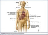 John+Hopkins+Medicine,+Haemochromatosis+Symptoms