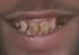 dl