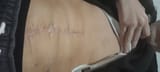 sashko scar