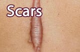 scars-web