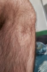 1000022010