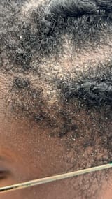 is-it-dry-scalp-or-dandruff-v0-vr48q44yg9yd1