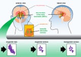5-1-graphic-brain-trans