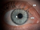 Iris-and-pupil-1024x769
