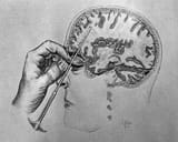 walter-freemans-transorbital-lobotomy-x-889183950