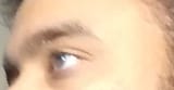 eye