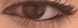 eye