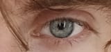 auge