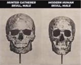 skull