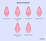 Types-of-hymen-1024x914