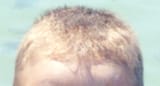 head