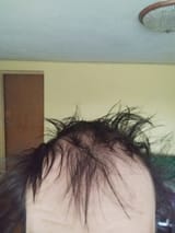 1730956187024817