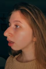 Potatonose