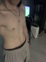 5726581