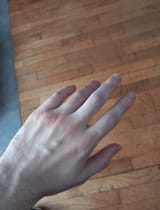 993159595931431114
