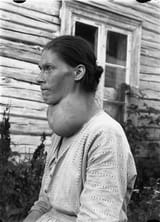 Kone_med_stor_struma