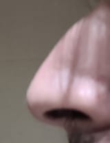 naso