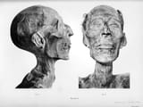 Mummy_of_Ramesses_II_-_02