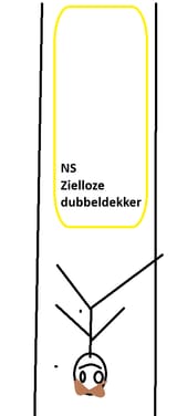 Treinpositiepreamputatie