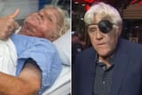 jay-leno-grossman-burn-center-eye-patch-042425-9dd35818c683466987b9aa2c5dd3bc1a[1]