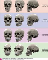 skull