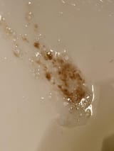brown-stuff-in-mucus