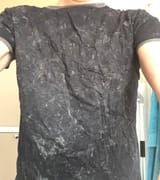 1738181908623228