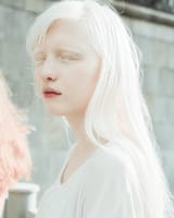 albino white
