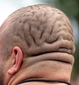 209977164-the-bald-head-of-a-fat-man-in-convolutions-close-up