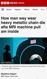 MRI machine suck man wey wear heavy metallic chain inside am - BBC News Pidgin
