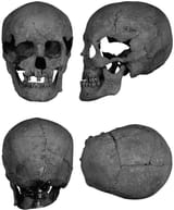 Budakalasz_Luppa_csarda_Skull_of_a_male_buried_in_Grave_412_Alpine