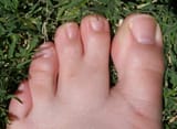 Webbed Toes