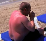 sunburnt_brit