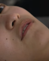 bitted lips