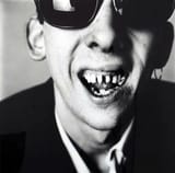 shane-teeth